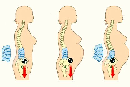 Mrt de la osteocondrosis de pecho
